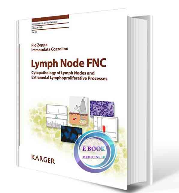 دانلود کتاب Lymph Node FNC: Cytopathology of Lymph Nodes and Extranodal Lymphoproliferative Processes (Monographs in Clinical Cytology, Vol. 23) 1st Edition 2018 (ORIGINAL PDF)